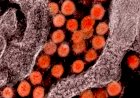 Fiocruz e Harvard explicam em estudo inflamação excessiva da covid-19