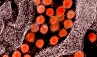 Fiocruz e Harvard explicam em estudo inflamação excessiva da covid-19