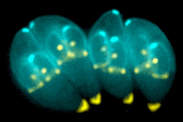 O parasita que infecta um terço da humanidade, mas ainda é negligenciado